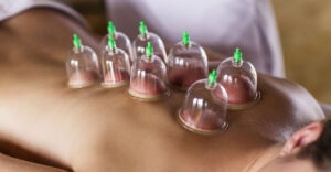cupping therapy - suction cup applied to a person's back by a professional